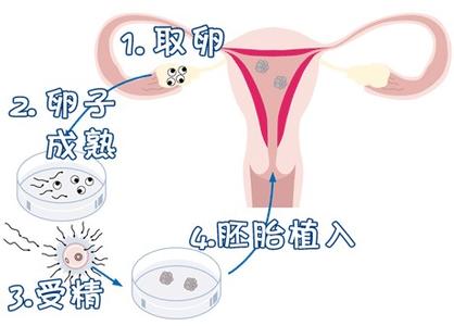 供卵代生咨询服务